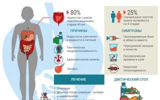 Заболевания толстого кишечника — признаки и способы лечения