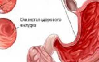 Высокая кислотность желудка лечение народными средствами