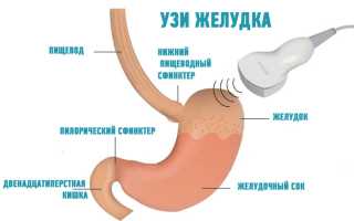Что показывает УЗИ желудка? Можно ли обнаружить язву или рак? Что показывает у детей?