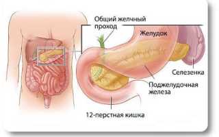 Дуодено гастральный рефлюкс: что такое, симптомы, лечение